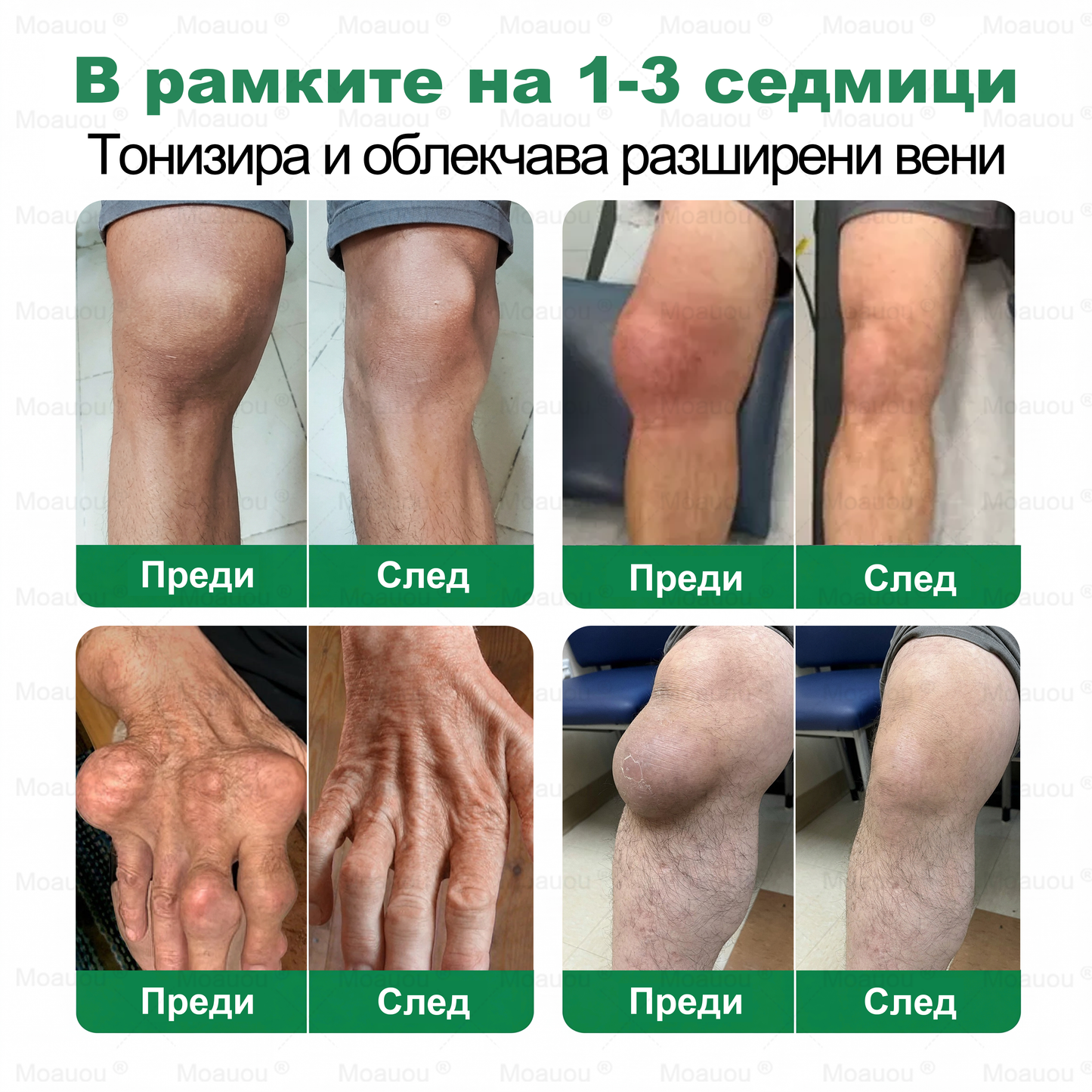 Moauou® Крем за вени и стави – целенасочено действие ⚡ Мигновено облекчение, дълготрайни резултати | Голяма разпродажба!