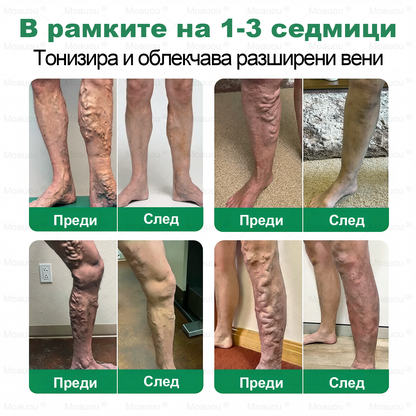 Moauou® Крем за вени и стави – целенасочено действие ⚡ Мигновено облекчение, дълготрайни резултати | Голяма разпродажба!
