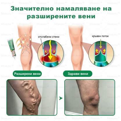 Moauou® Крем за вени и стави – целенасочено действие ⚡ Мигновено облекчение, дълготрайни резултати | Голяма разпродажба!
