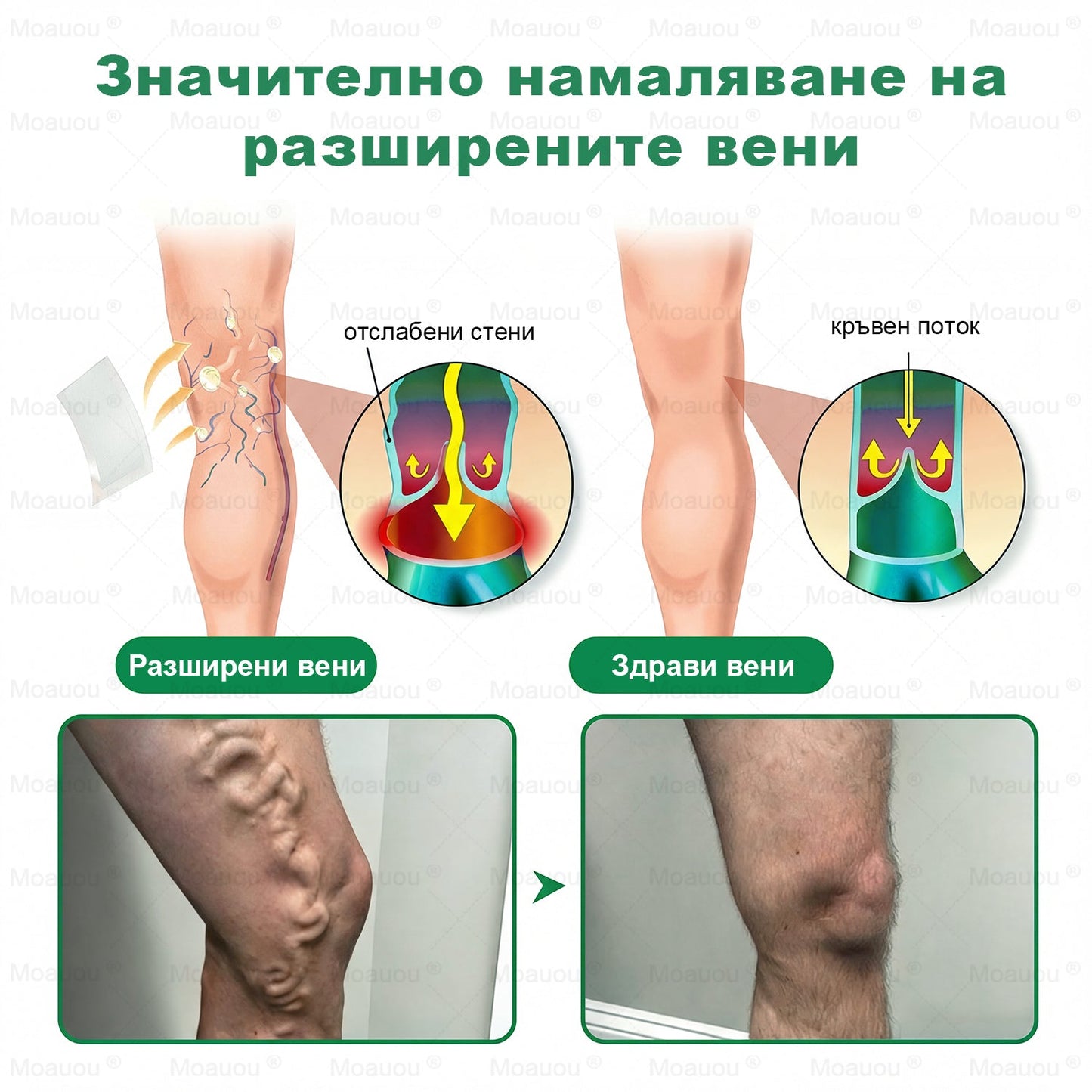 🎁 Остават само 5 кутии! Сега с допълнителна отстъпка от 50%! Укрепете тялото си, живейте здрави! Действайте сега — догодина няма да има шанс!
