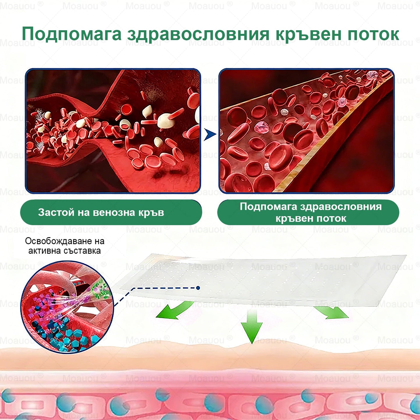 Moauou® Микроиглен пластир за таргетирано действие при разширени вени ⚡Незабавно облекчение, дълготраен ефект — специална промоция